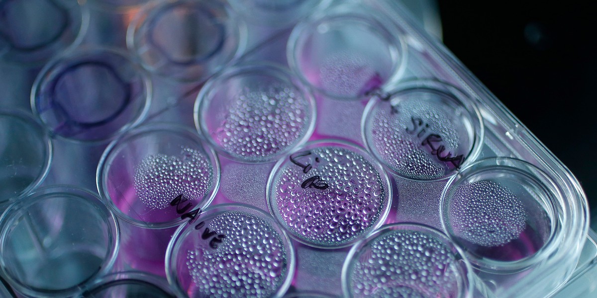 A tray containing cancer cells sits on an optical microscope in the Nanomedicine Lab at UCL's School of Pharmacy in London.