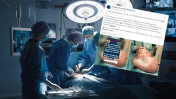 Niemieccy lekarze usunęli 24-latce guz ważący 32 kg! Polski rekordzista był jeszcze większy