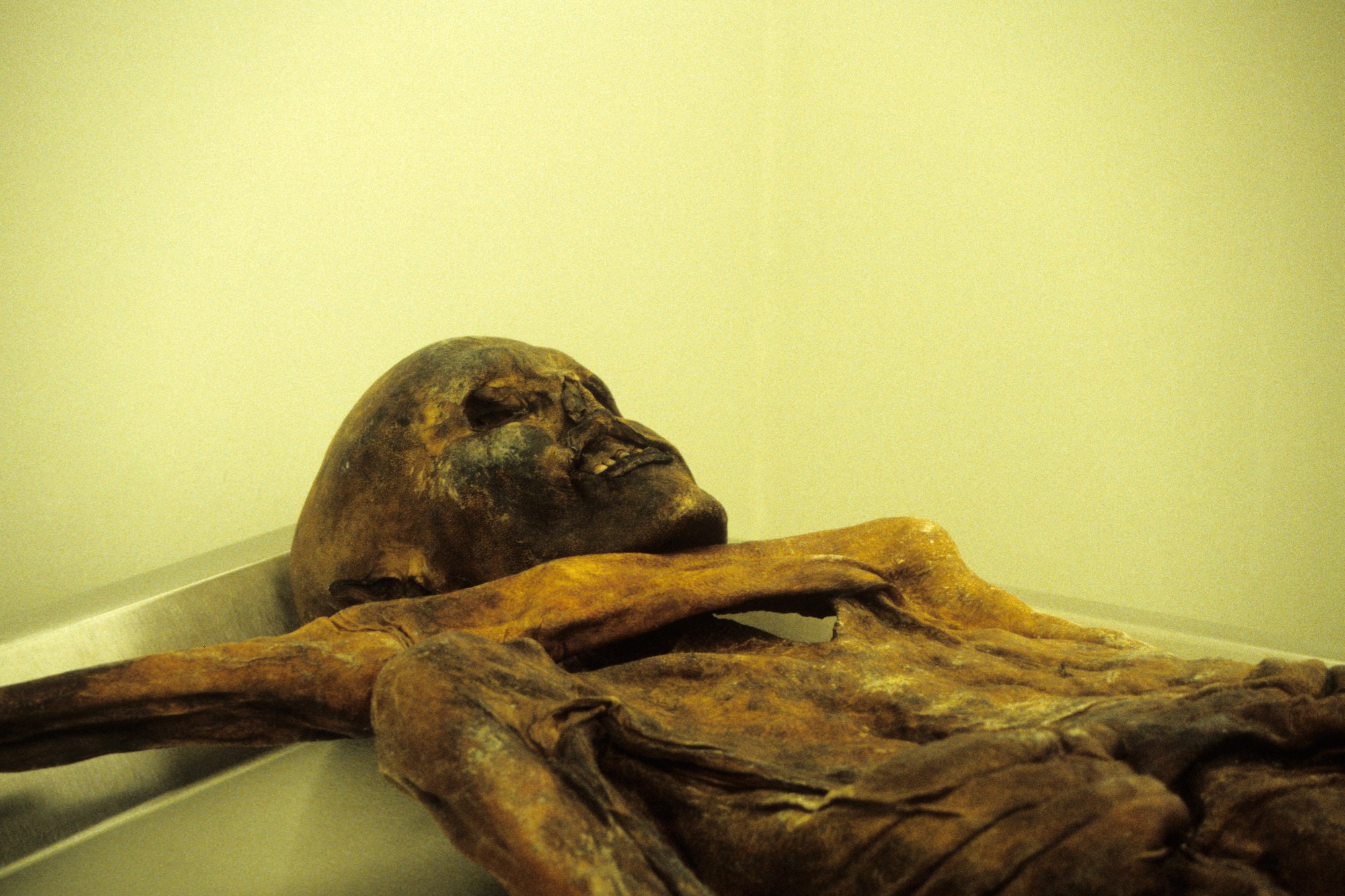 Ötzi