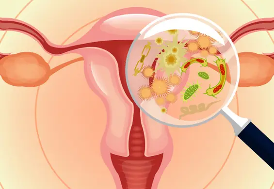 9 najczęściej ignorowanych objawów torbieli jajników. Nie lekceważ ich!