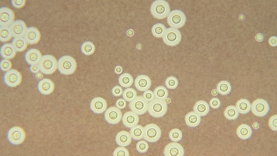 Grzyb Cryptococcus deneoformans/ Domena Publiczna