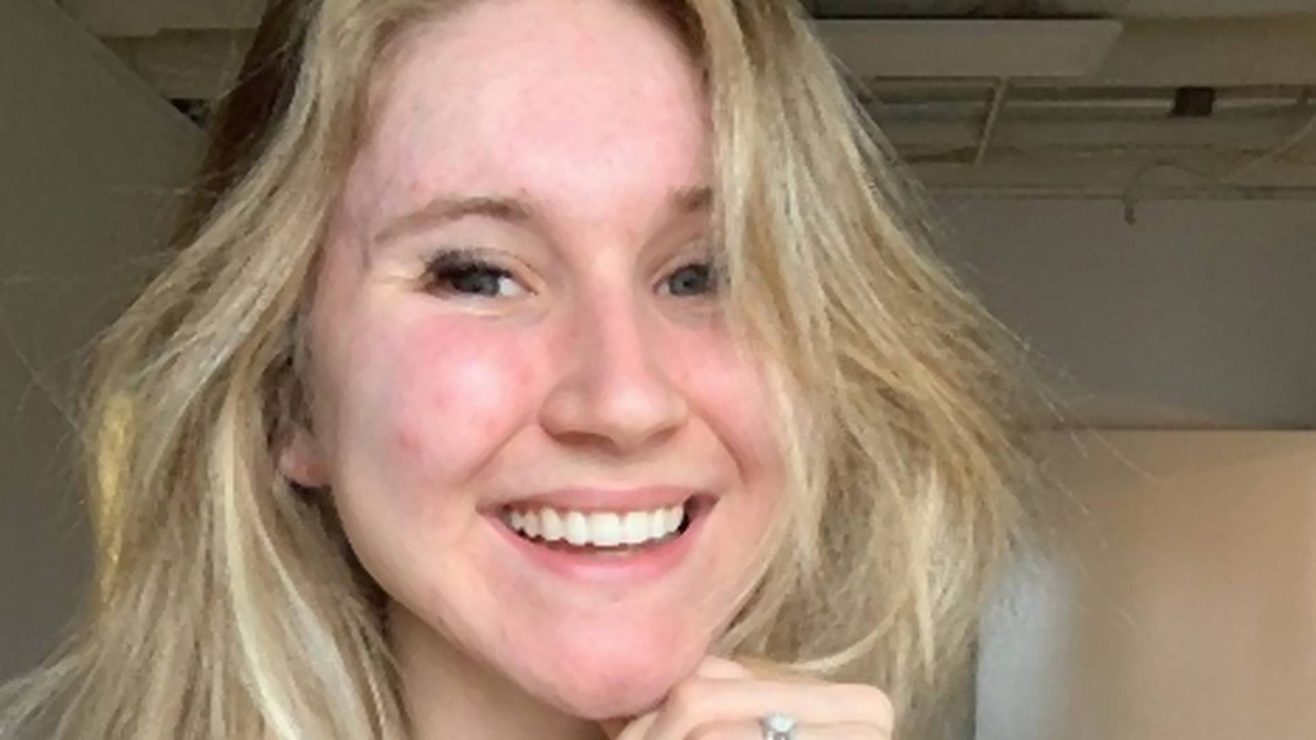 Instagram zvezda koja je preko noći izgubila 70.000 pratilaca