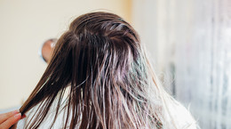 Przetłuszczające się włosy - przyczyny, zapobieganie, domowe sposoby