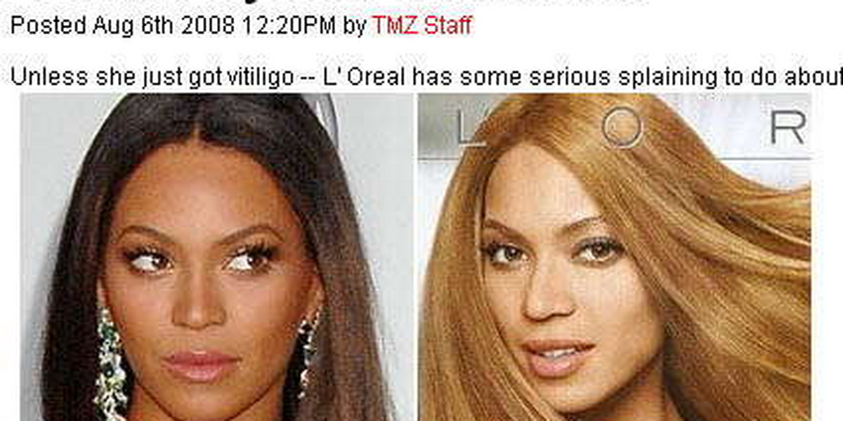Bo twarz Beyonce była zbyt czarna?