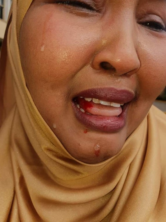 Wajir Woman Rep Fatuma Gedi badly beaten up Wajir East MP Rashid Kassim at Parliament buildings 