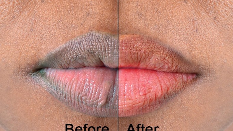 lips-here-are-5-naturally-ways-to-make-them-soft-and-pink-pulse-nigeria