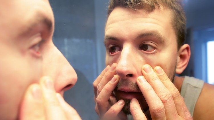 hipochonder pánikbetegség kényszerbetegség szorongás