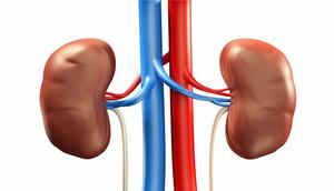 kidney disease