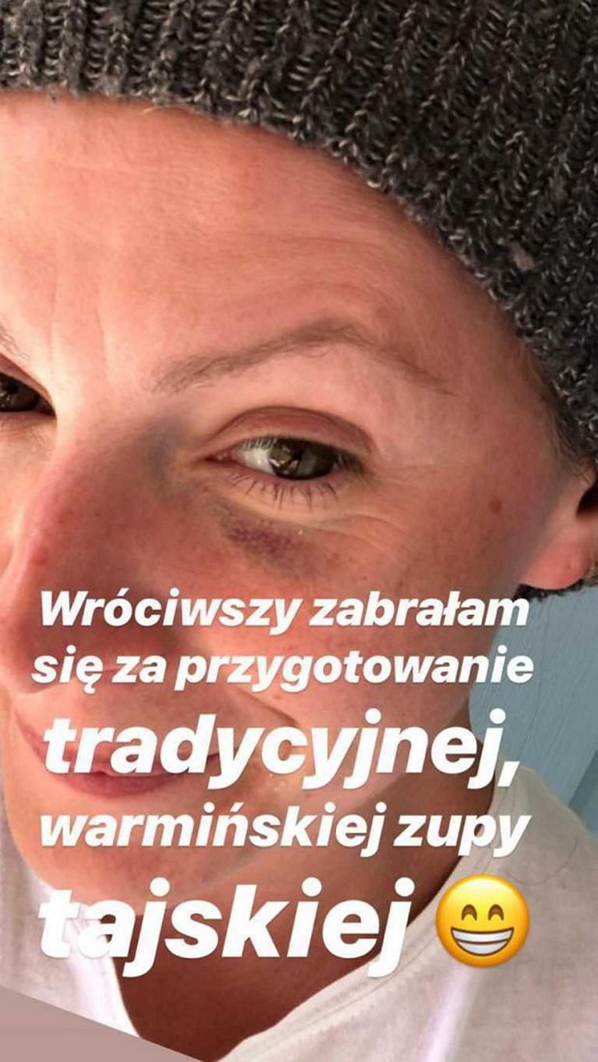 Szelągowska miała wypadek