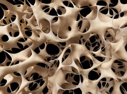 Prawie 30 proc. Polek cierpi na osteoporozę. Co trzeba wiedzieć o chorobie?