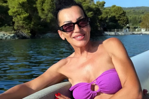 SKINULA SE NAŠA PEVAČICA (61) Ponosno pozirala u bikiniju, a zbog botoksa joj se lice deformisalo: "Bila sam kao plastična lutka"