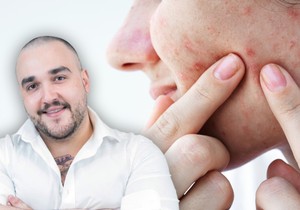 Dr Branislav Lukić, specijalista oftalmologije i sertifikovani lekar estetske medicine