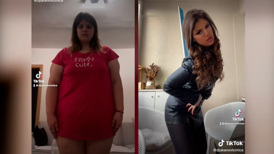 Drstična promena Miličinog izgleda