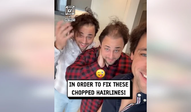 Braća Vizli počela da gube kosu jako rano