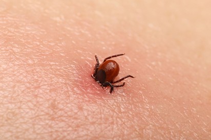 A kullancscsípés helyén pici rózsaszínes bőrpír van, ez Lyme-kór? Az orvos válaszol