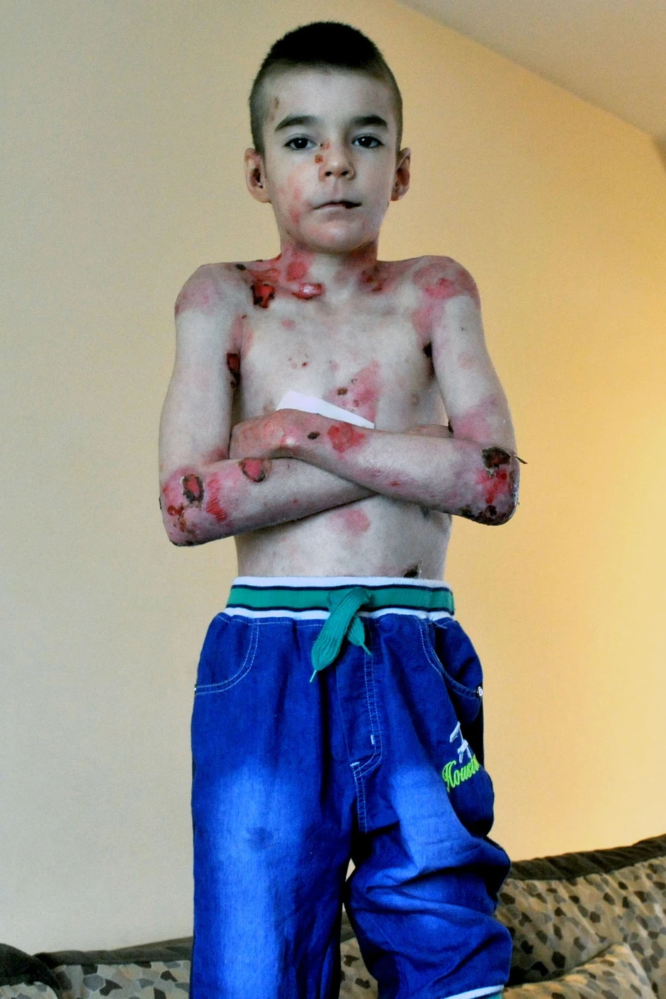 Despot Lazić, dečak leptir