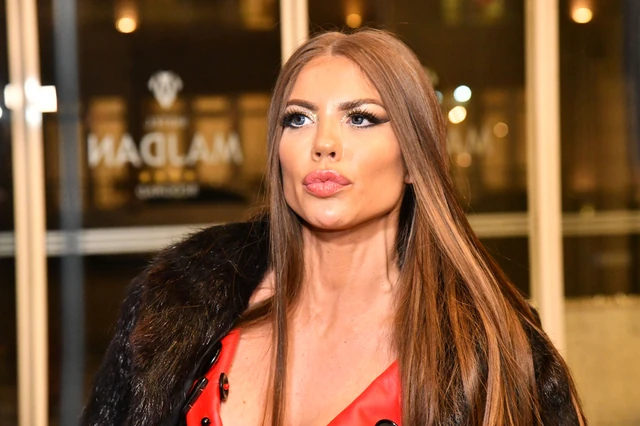 Važila za prirodnu lepoticu u rijalitiju, a onda iskeširala 150.000 evra za ESTETSKE KOREKCIJE, fanovi kažu "VIŠE TO NIJE ONA" (FOTO)