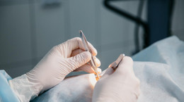Pierwszy w Polsce przeszczep komórek macierzystych rogówki u dziecka