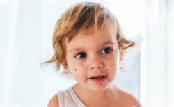 Pozytywny skutek obostrzeń w pandemii: Spadła liczba zachorowań na ospę