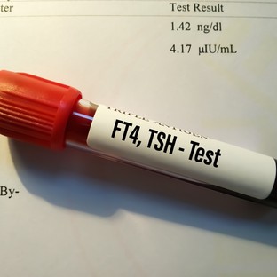 Mit jelent a FT4 (szabad T4) érték a laborleleten?