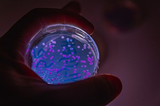 Odkrycie, które przyniesie rewolucję? Ta bakteria może produkować paracetamol z... plastiku