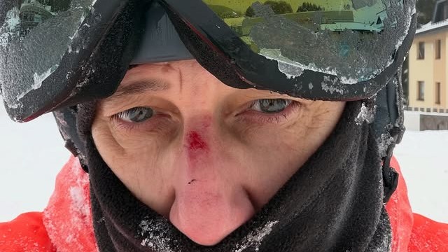 Slovenský tenorový spevák Marian Vojtko mal nehodu na svahu. 