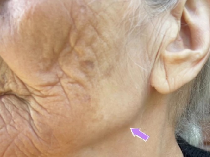 Baka (96) otkrila deo lica koji nije bio izložen suncu - i šokirali smo se