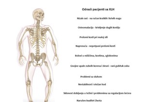 Osteomalacija