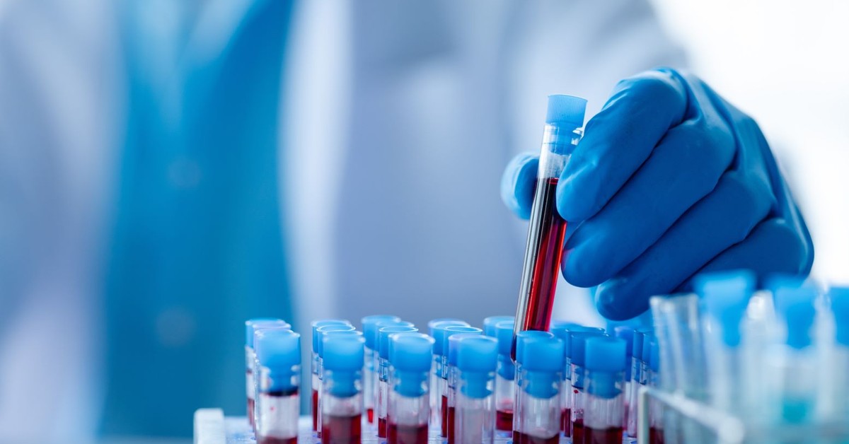 Rządzący dbają o krwiodawców, ale nie zawsze. Mogą skorzystać z ulgi podatkowej i dostać medal, ale na trzynastce stracą