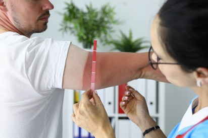 6 tanács a bőrgyógyásztól - így védekezzen a nap káros sugarai ellen