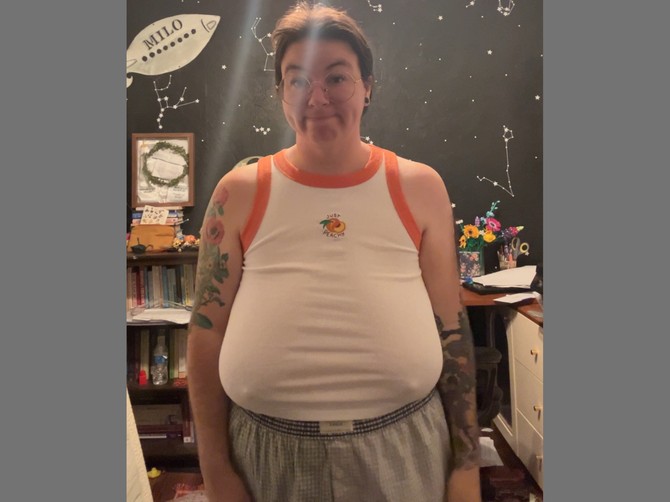 Kameron Lajt pre operacije