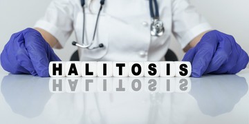 Halitózis, rossz szájszag: oka, tünete és kezelése