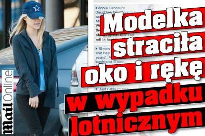 Modelka straciła oko i rękę w wypadku lotnicznym