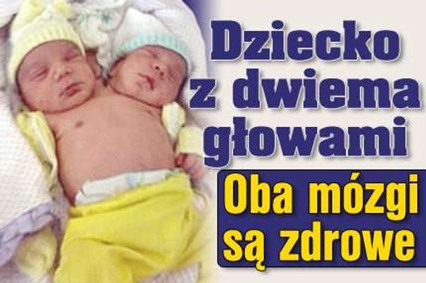 Dziecko ma dwie głowy. Oba mózgi są zdrowe. FILMY