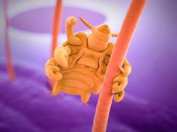 A lapostetvesség (Pediculosis pubis) kórokozója a lapostetű (Pthirius inguinalis), egy pajzs alakú vérszívó rovar.