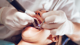 Ekstrakcje zębów