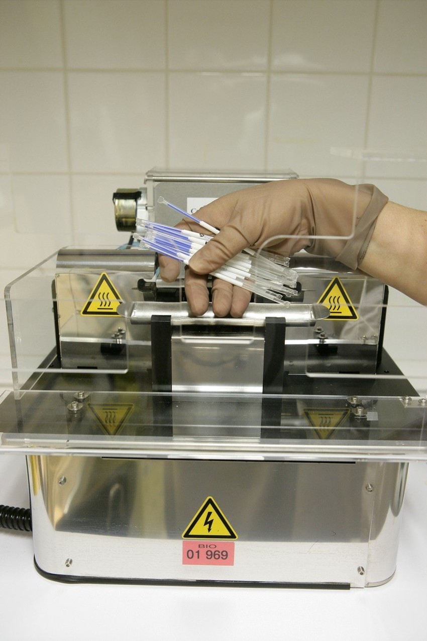 Iako bolnica nije sačuvala spermu pacijenta, uredno je naplaćivala račun tri godine