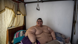 Sokkoló: fotók a világ legkövérebb emberéről, aki 170 kilót fogyott le