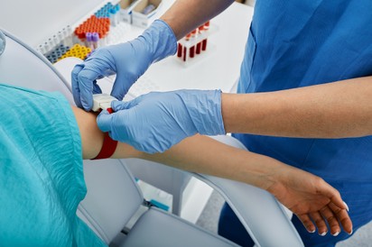 Vastagbélrák szűrés vérvizsgálattal? Ebben az esetben válthatja ki a kolonoszkópiát