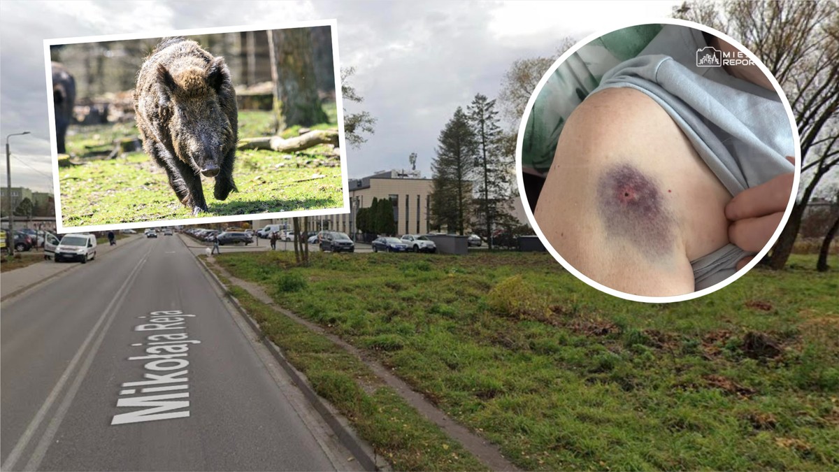 Dramat seniorki w Wołominie. Kilka kroków od ZUS-u brutalnie zaatakował ją dzik