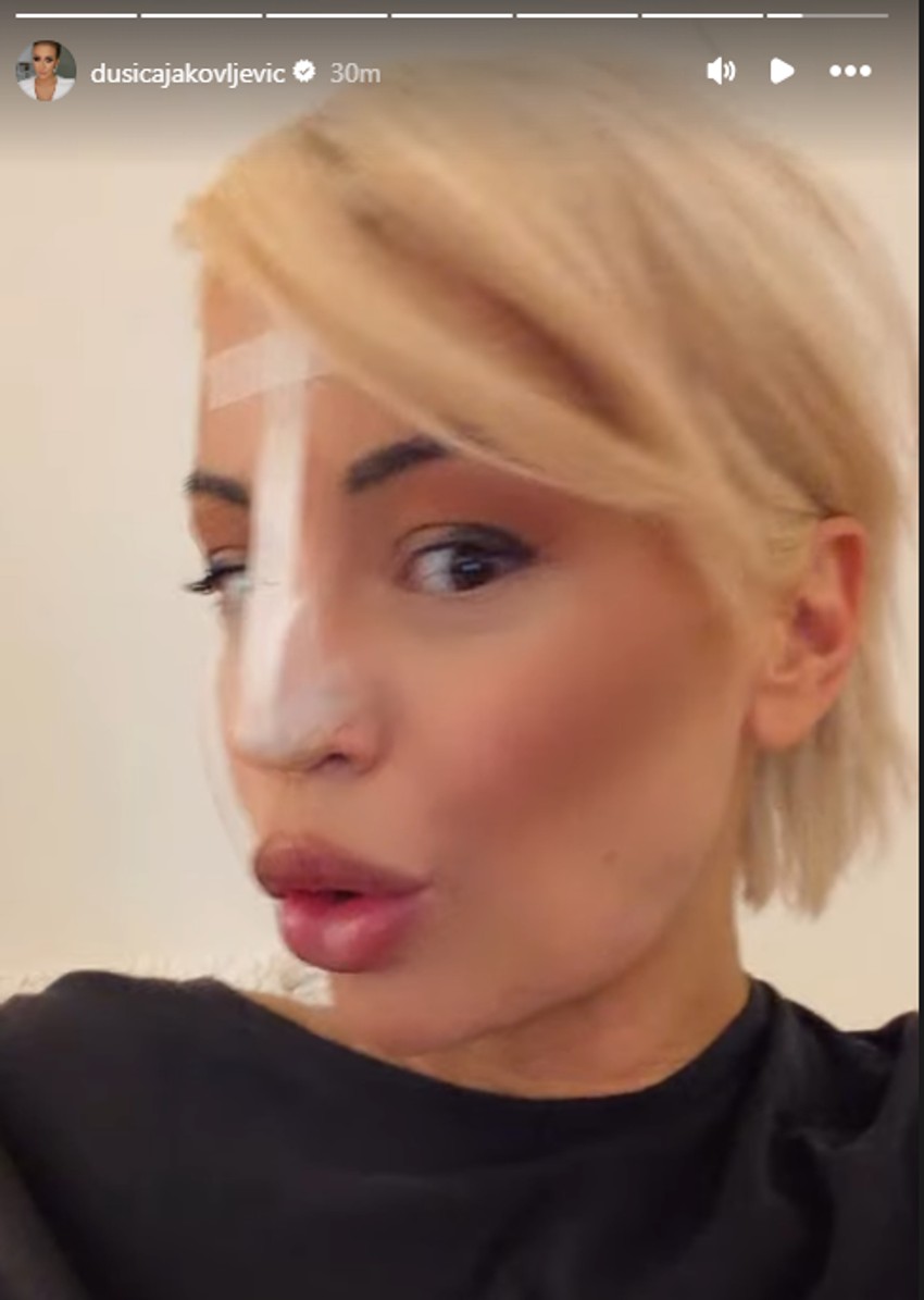 Dušica Jakovljević skroz oblepila nos flasterima, šokira: "Pao mi je vrh" nosa"