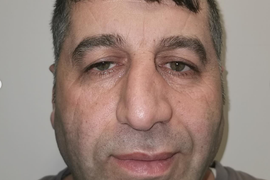 Turci od uvenulog muškarca napravili BRUTALNOG FRAJERA, novi nos je VRHUNAC estetske hirurgije: Ovom transformacijom PREVAZIŠLI SU SEBE