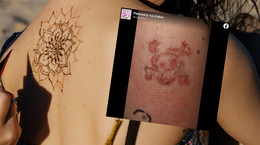 Uwaga na tatuaże z henny