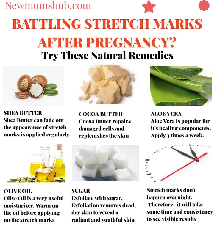 Battling Stretch Marks After Pregnancy? Try These Natural Remedies 