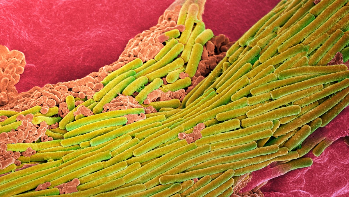 Clostridioides difficile