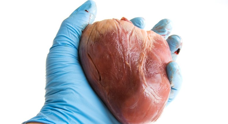 Human heart