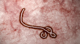 Wirus Ebola zabija co drugą zakażoną osobę. Nadzieja w wyższej dawce