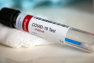 Za mało testów na COVID-19. To oznacza brak kontroli nad pandemią