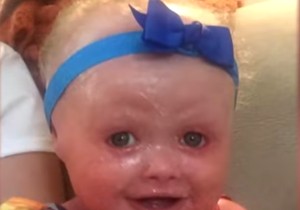 Arlekinov fetus Ana Vilklou