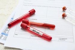 Cicha epidemia. W Polsce co trzeci zakażony wirusem HIV o tym nie wie